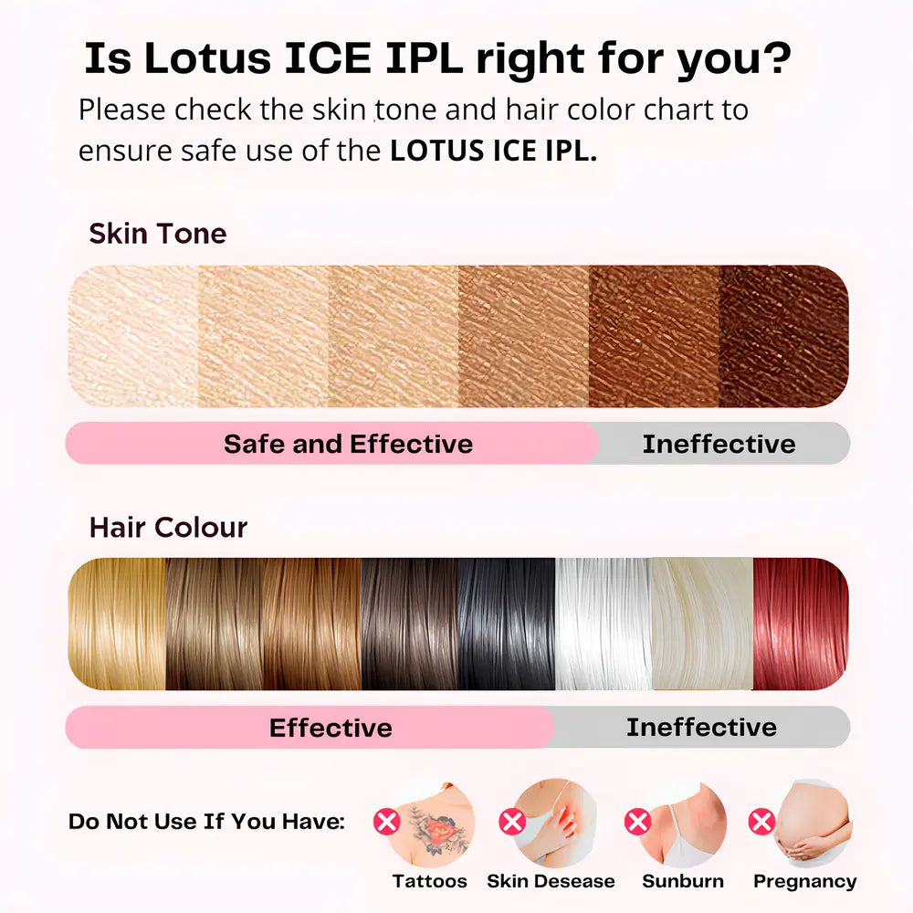 Lotus ICE IPL